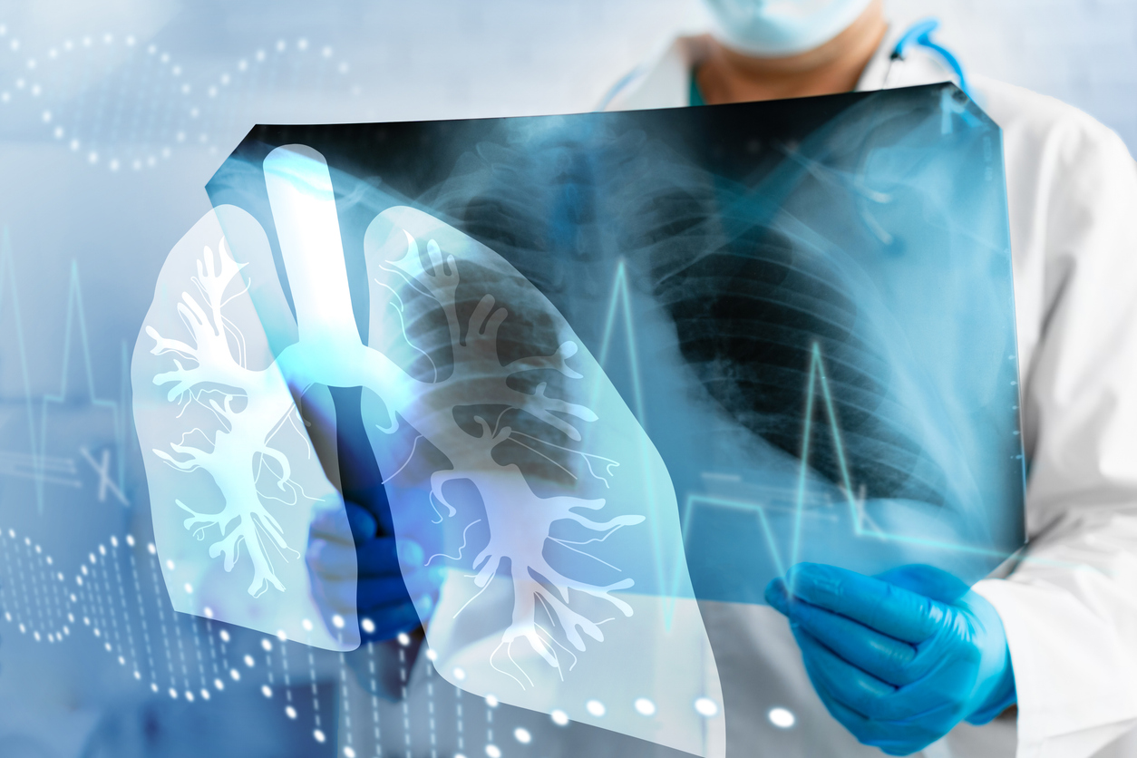 Образовательная сессия &laquo;Пульмонология мегаполиса&raquo;